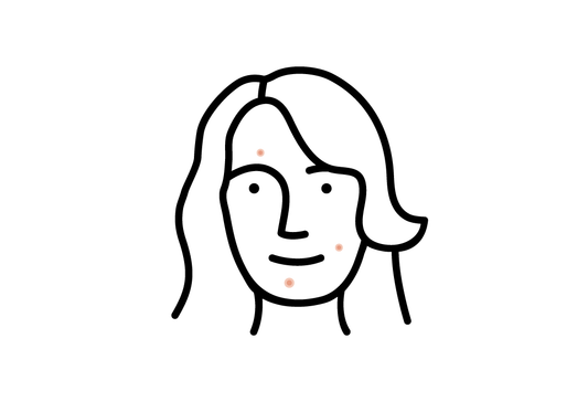 rostro-mujer-granos-acne
