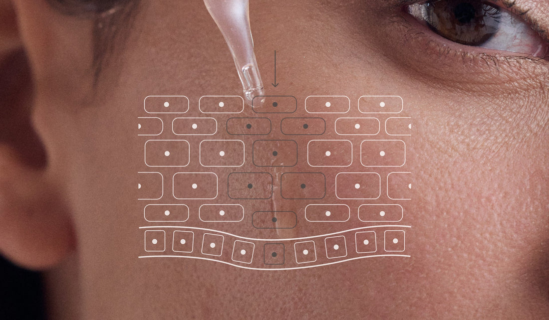 Melasma: ¿cómo lo trato?